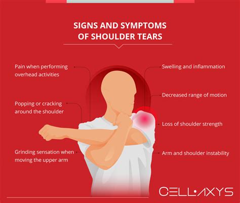 shoulder torn labrum symptoms